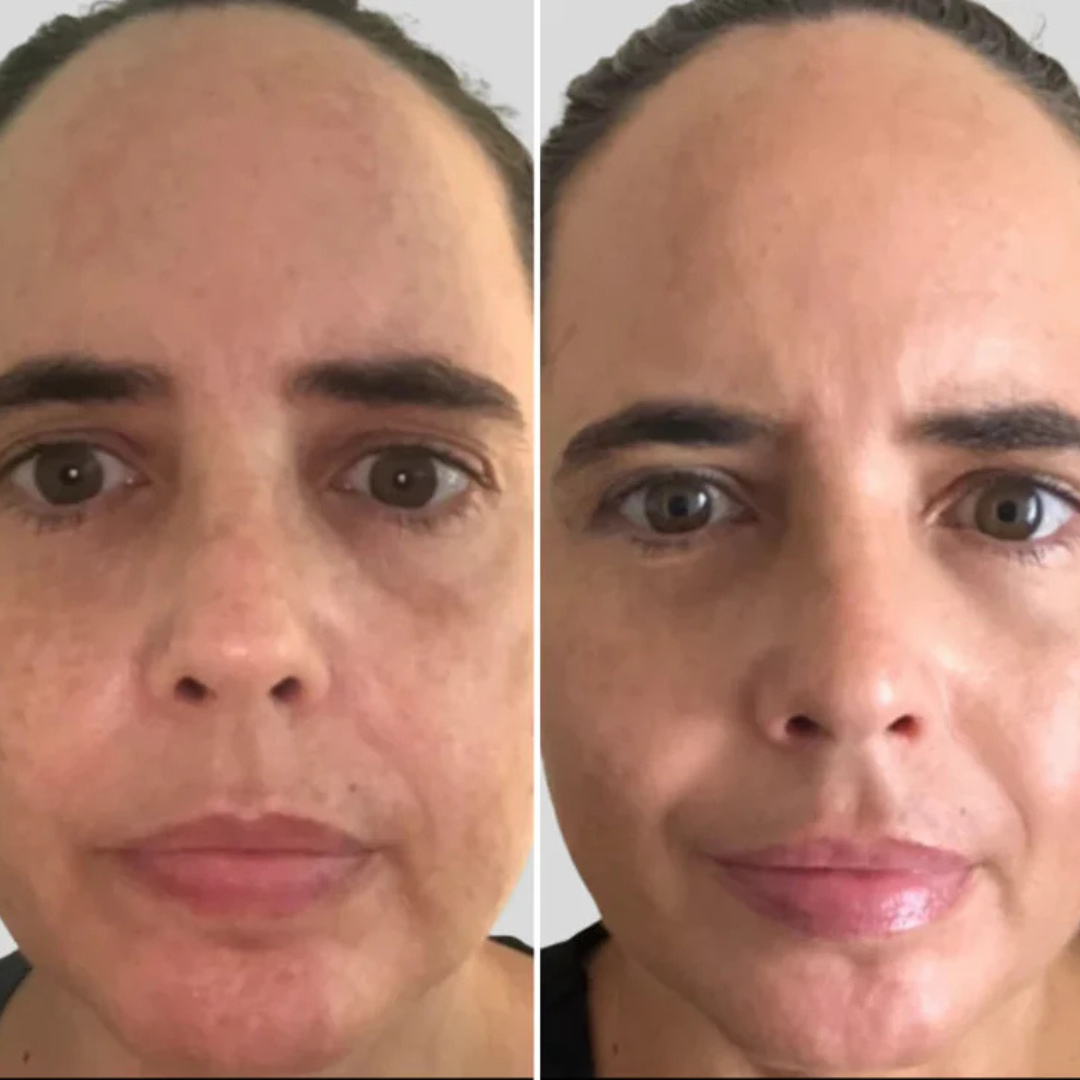 Masque LED Rajeunissant en Silicone – Éclat & Soin Complet à Domicile